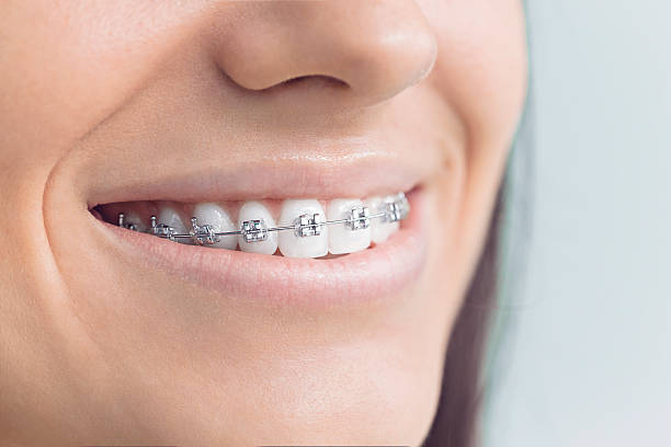 Best Root Canal Treatment  in West Union, OH